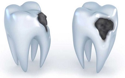 Kavya Dental Clinic